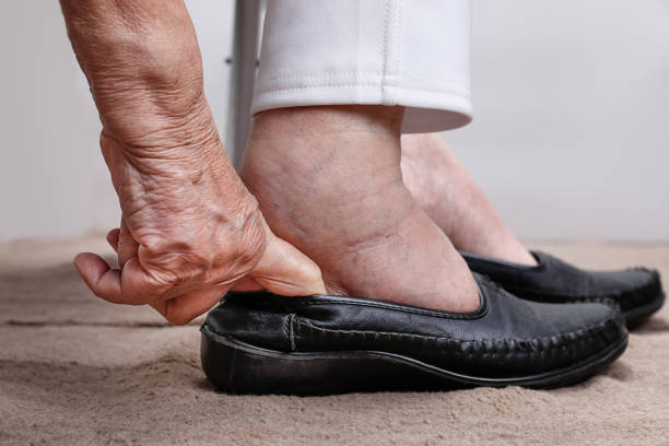tips-memilih-sepatu-running-yang-nyaman